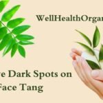 WellHealthOrganic.com: Remove Dark Spots on Face Tang